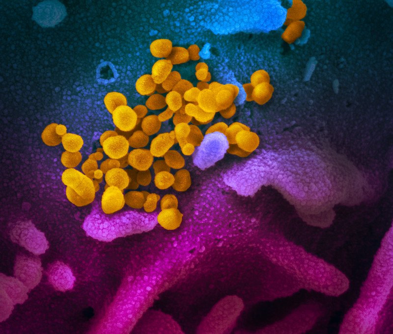 
This scanning electron microscope image shows SARS-CoV-2 (yellow) — also known as 2019-nCoV, the virus that causes COVID-19 — isolated from a patient in the U.S., emerging from the surface of cells (blue/pink) cultured in the lab. (NIAID-RML)
